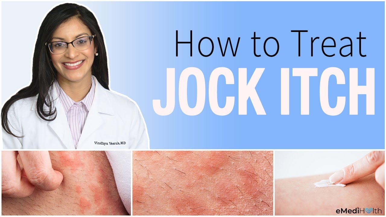 jock itch healing stages